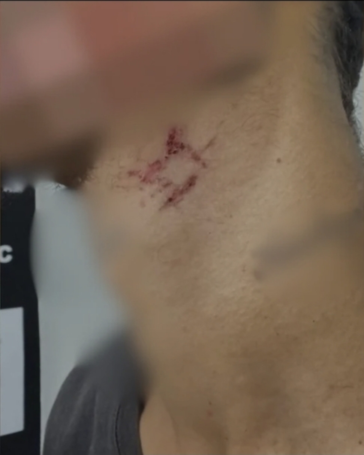 Escravo sexual é resgatado após passar mais de um ano em cárcere