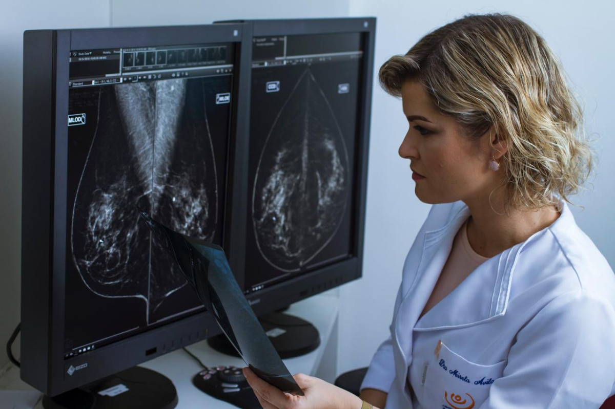 Uma a cada três pernambucanas diagnosticadas com câncer de mama tem menos de 50 anos 